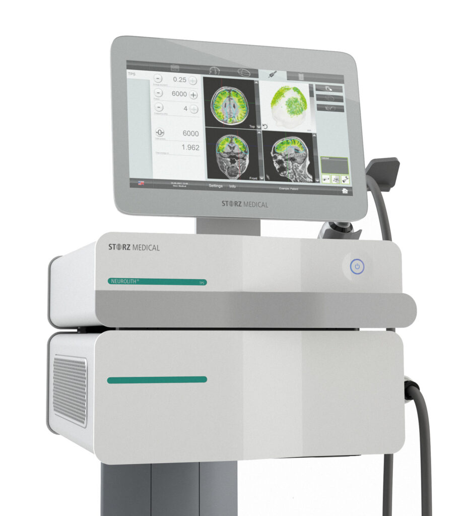 Transkranialna pulzna stimulacija
